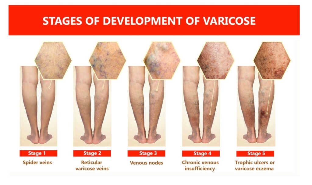 Photo Credit: Society for Vascular Surgery